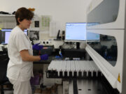 Detectat el virus del papil·loma en 3.691 dones a Girona gràcies a un nou mètode de cribratge del càncer de coll uterí